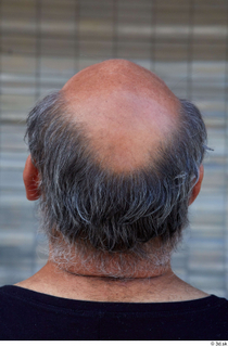 Street  785 bald hair head 0001.jpg